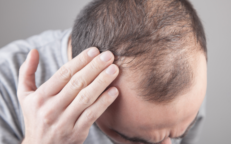 Hair Breakage Common Causes And Treatment